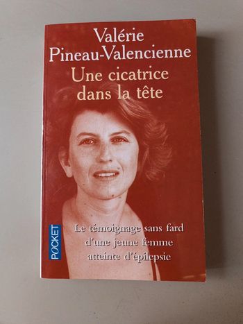 Valérie Pineau Valenciennes une cicatrice dans la tête. Une femme atteinte d'épilepsie