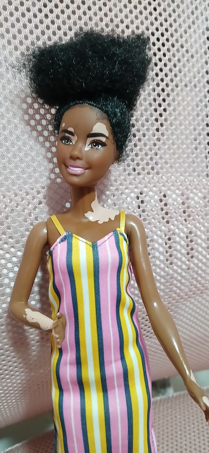 Barbie vitiligo - photo numéro 2