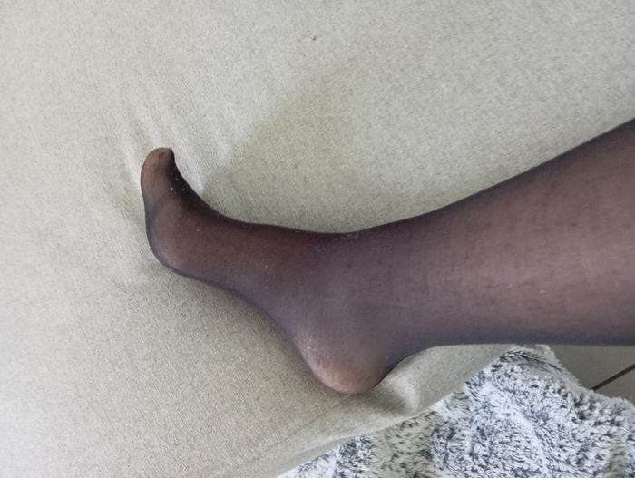 Collant - photo numéro 3