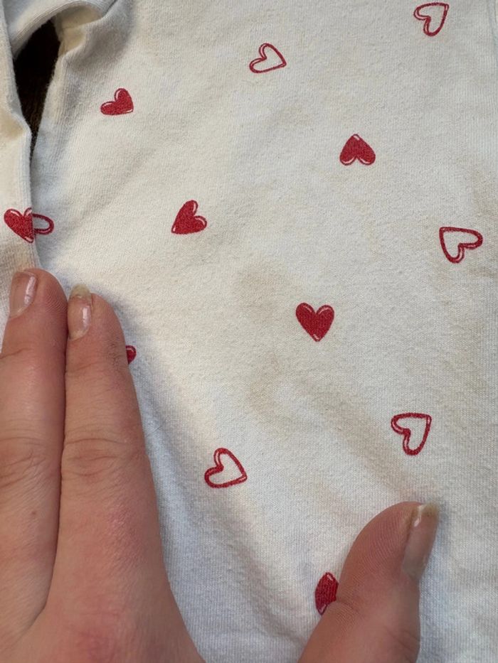 Grenouillère cœur 24m - photo numéro 2