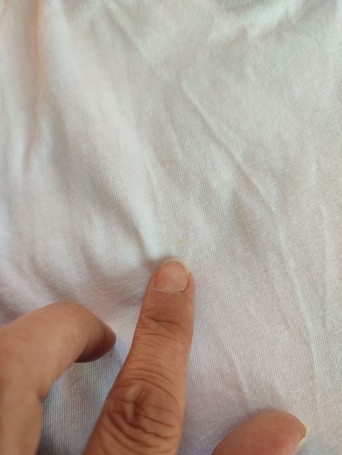 Robe été - photo numéro 4