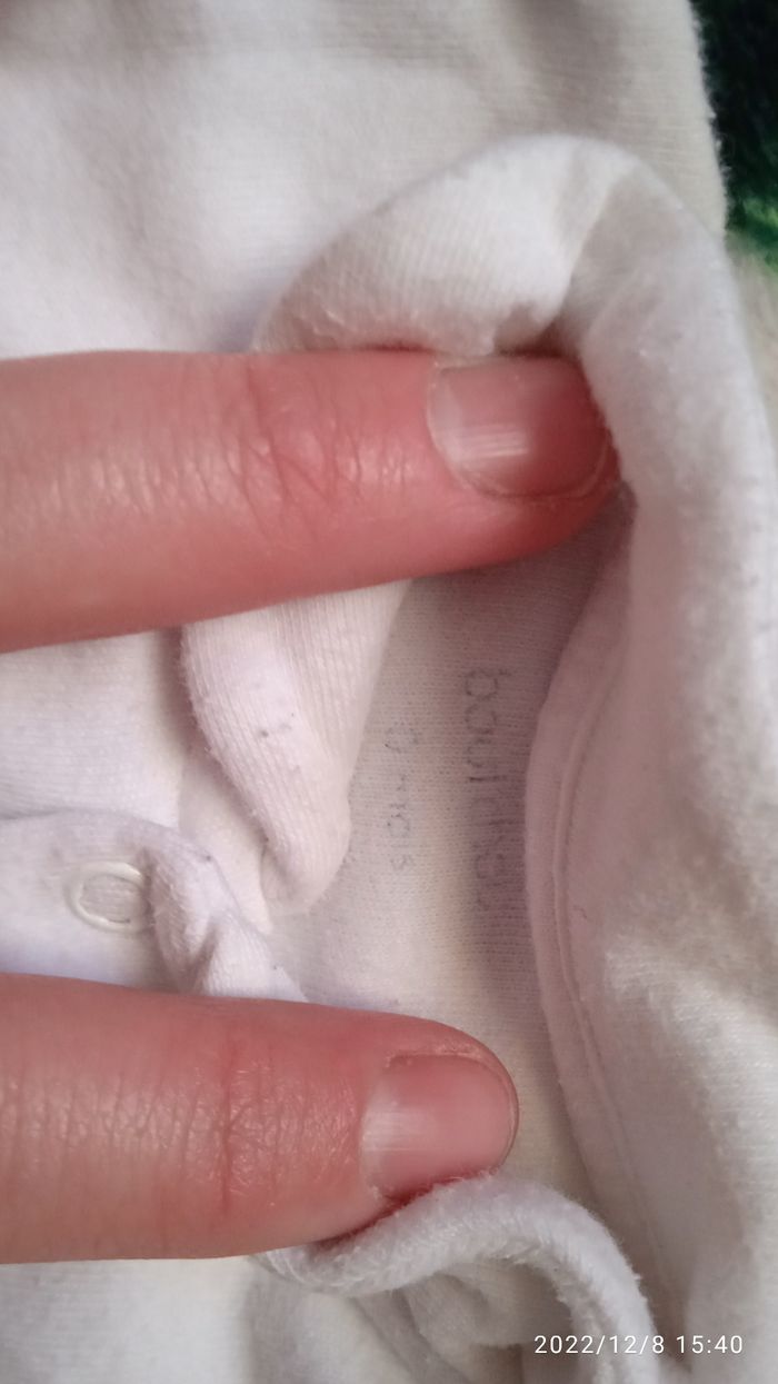 Body - photo numéro 2