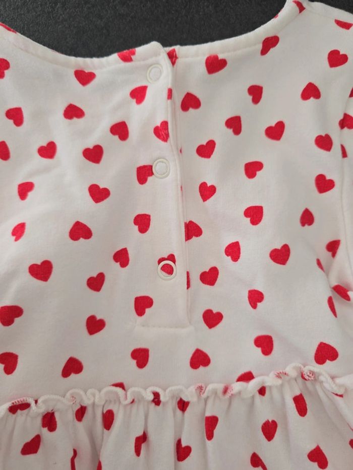 Robe Primark 12/18 mois - photo numéro 4