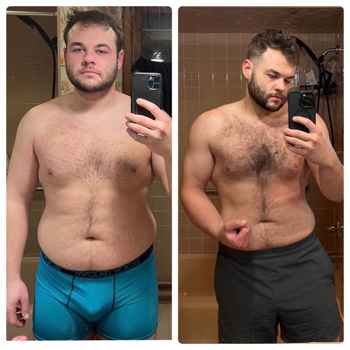 Santé fragile Surpoids - photo numéro 3