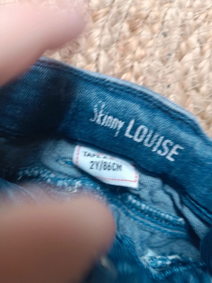Skinny Louise - photo numéro 2