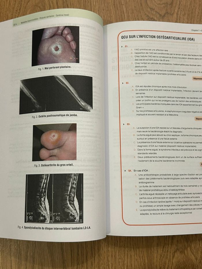 Livre référentiel Orthopédie traumatologie ECN - photo numéro 4