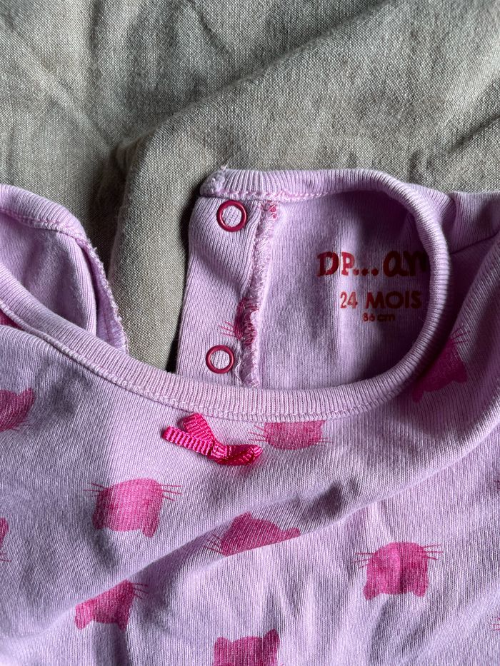 Body - photo numéro 2