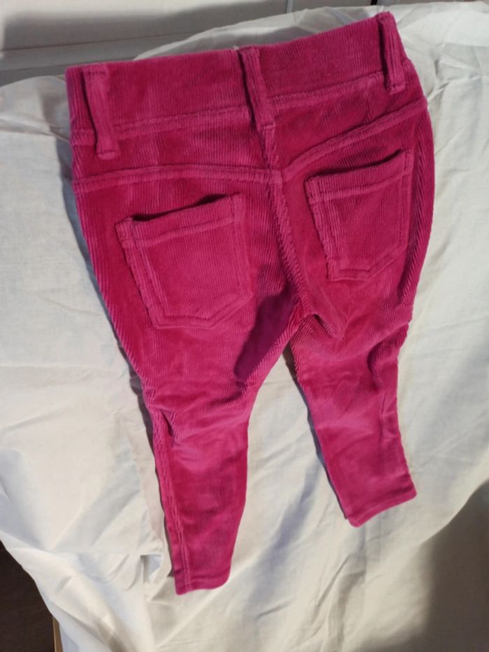 Skinny Benetton - photo numéro 4