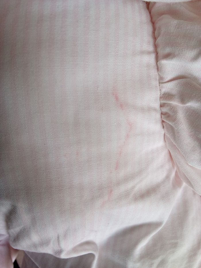 Peluche doudou lapin rose et blanc vintage ancien  bicolore rayure rayé en posture debout col dentelle blanc yeux durs en plastique pupille noir contour transparent  gris  foncé  tâches roses en photos  sinon très propre  modèle pas récent les jouets qui  - photo numéro 6
