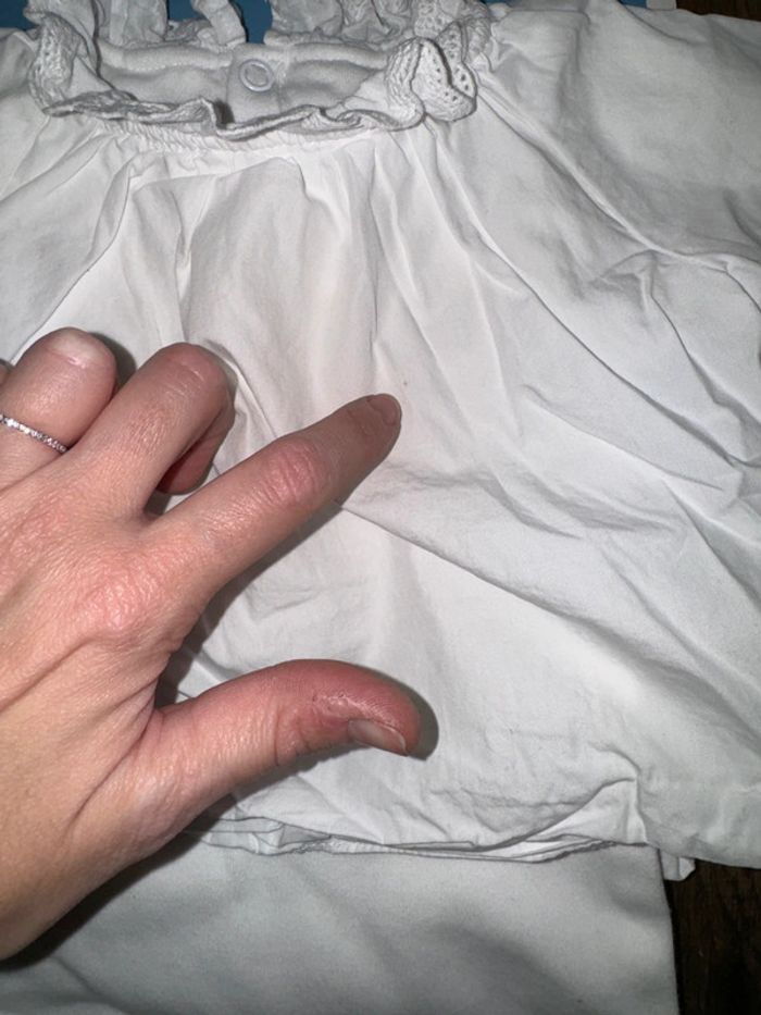 Body guimpe Jacadi 6 mois Une micro trace - photo numéro 3