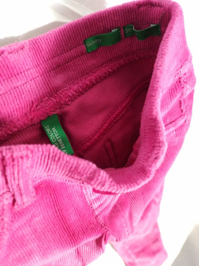 Skinny Benetton - photo numéro 2