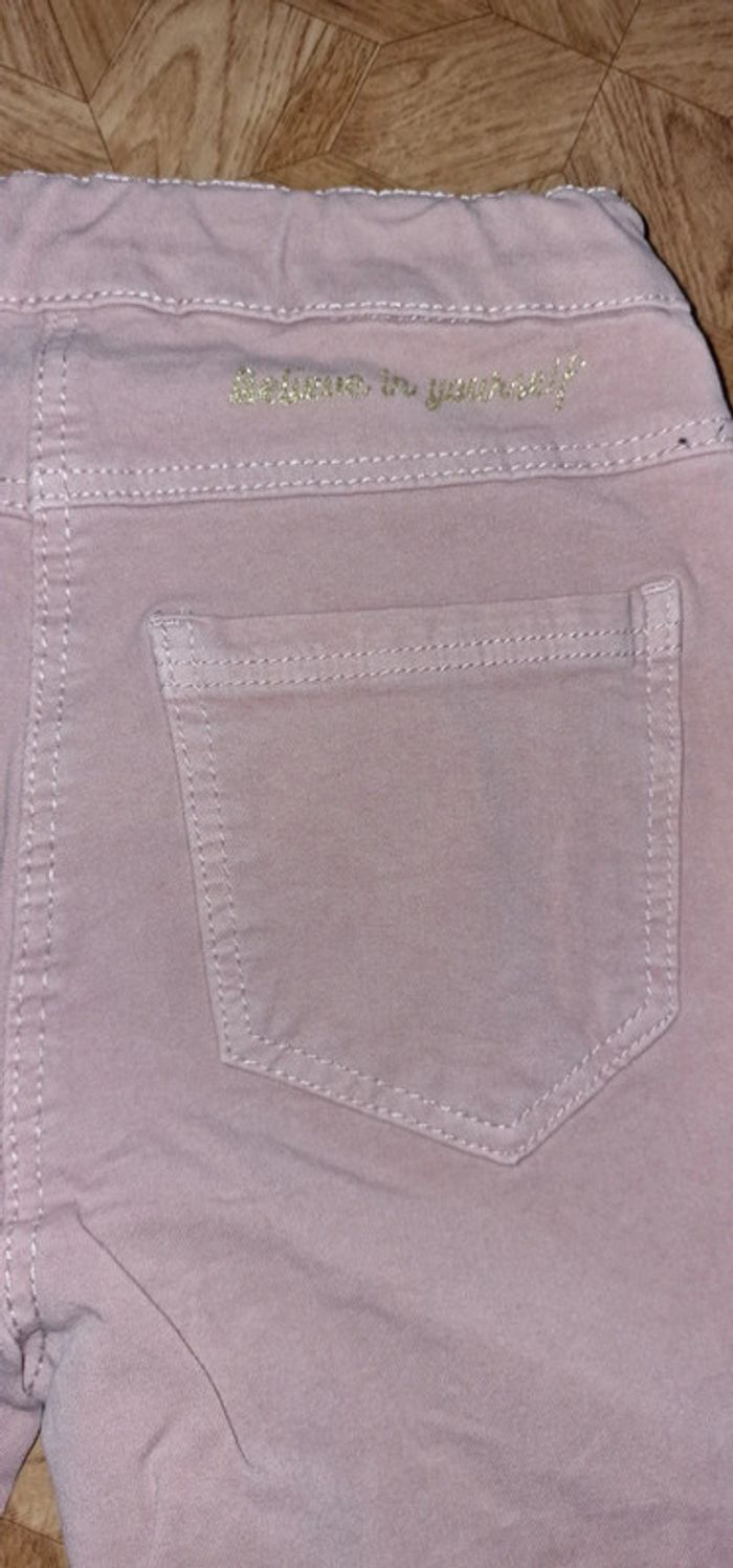 Jean 10ans tape a loeil - photo numéro 3