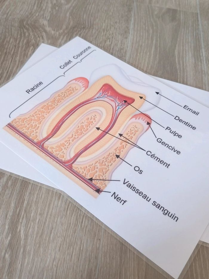 Kit anatomie de la dent saine et la dent cariée - photo numéro 8