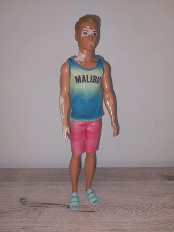 Barbie ken avec tâches de naissance