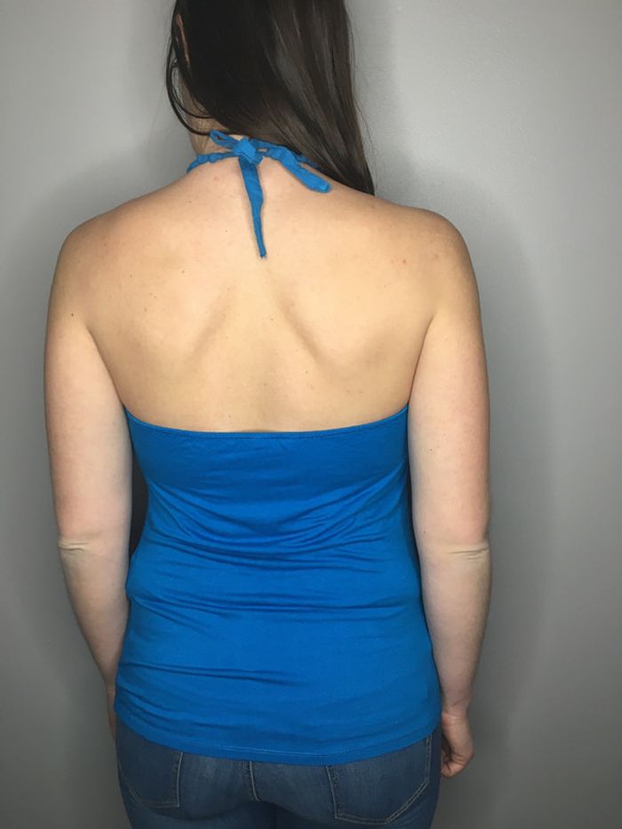 Dos nu bleu - photo numéro 2