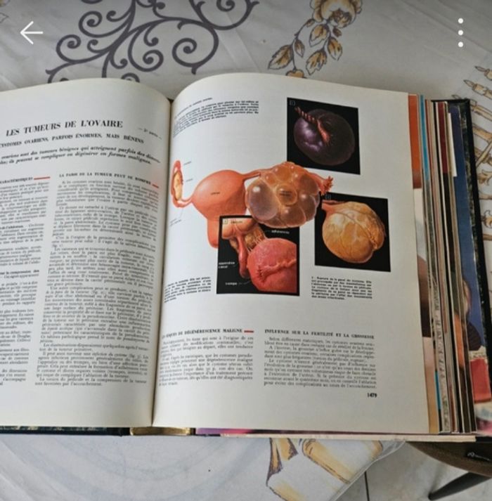 Encyclopédie médicale pour tous - photo numéro 4