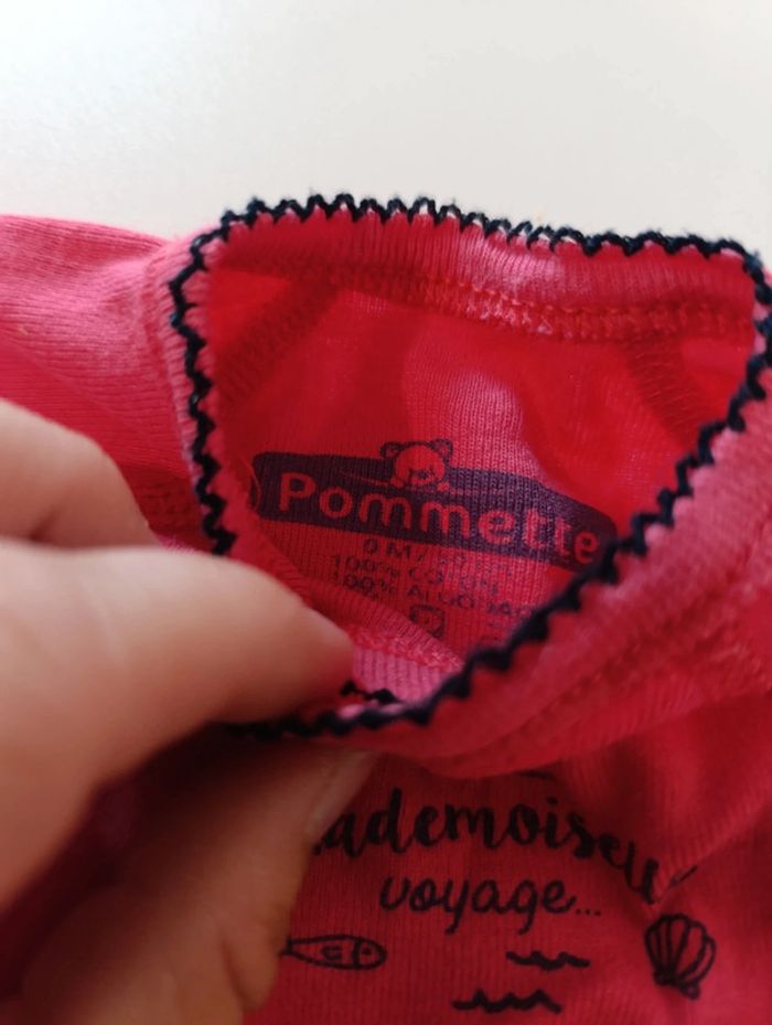 Bodie naissance pommette - photo numéro 3