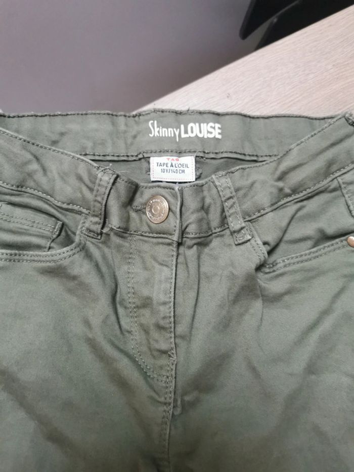 Skinny 10 ans - photo numéro 2