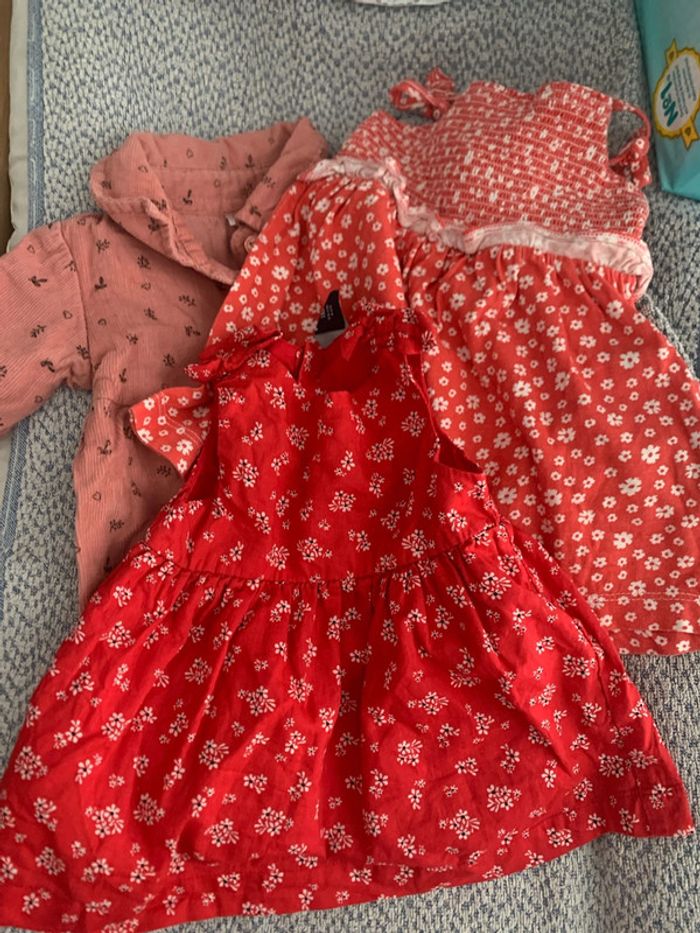 Robe bébé