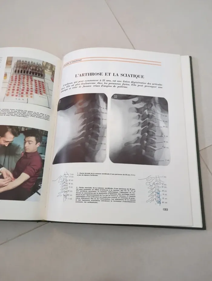 Encyclopédie médecine pour vous tome 6 hachette - photo numéro 4