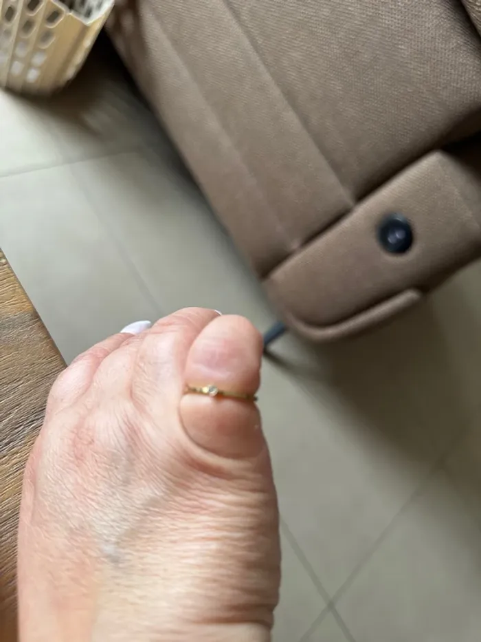 Bague acier chirurgical - photo numéro 2