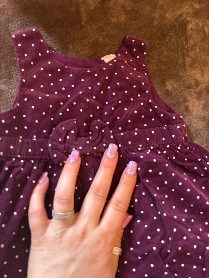 Robe fille 6 mois - photo numéro 2