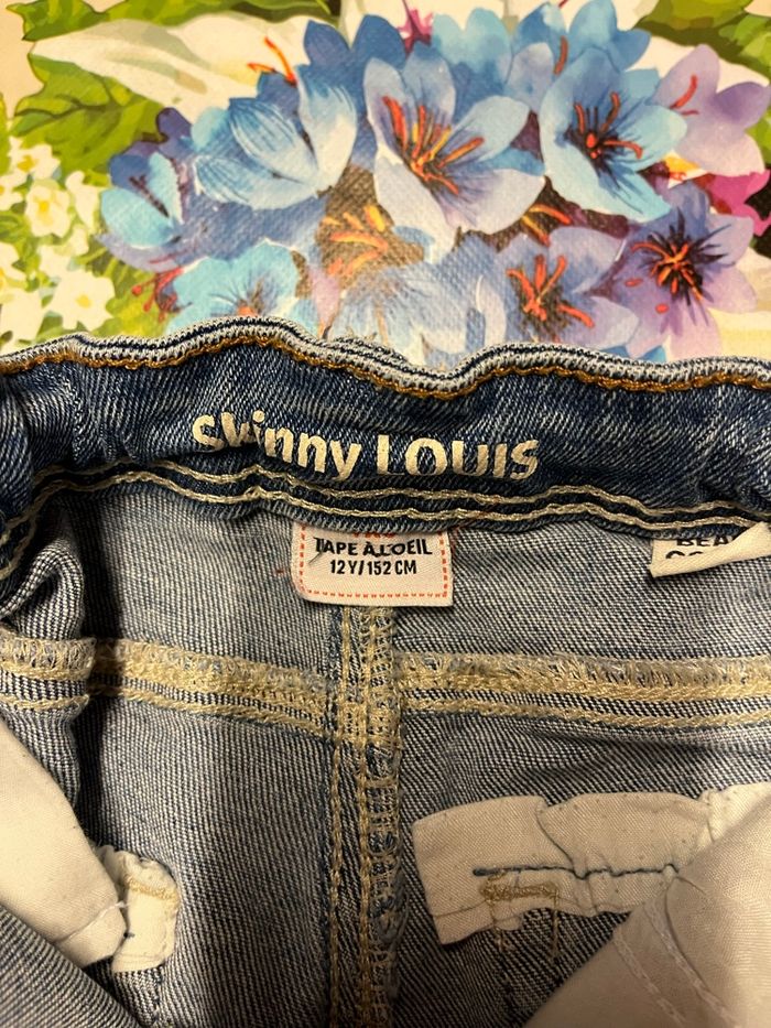 Skinny - photo numéro 5