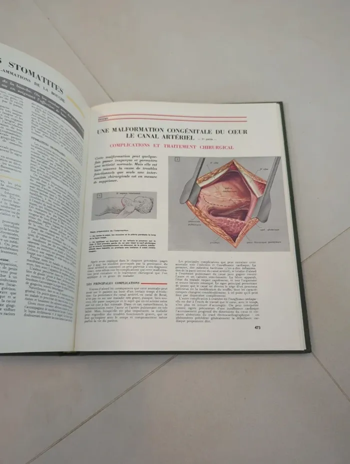 Encyclopédie médecine pour vous tome 2 hachette - photo numéro 5