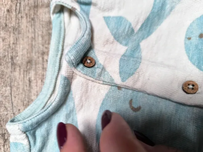 Grenouillère - photo numéro 2