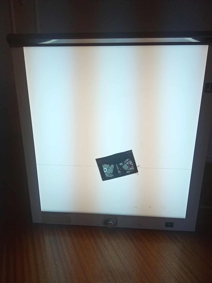 Visionneuse radiographie