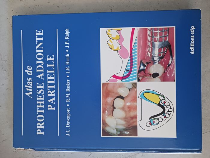 atlas de prothese adjointe partielle
