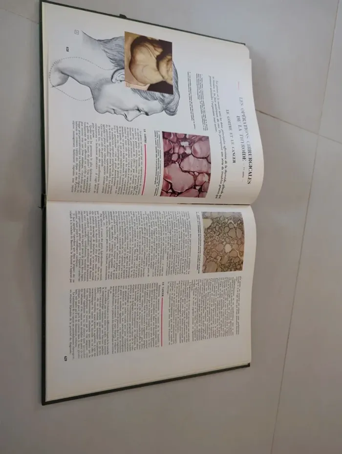 Encyclopédie médecine pour vous tome 3 hachette - photo numéro 3