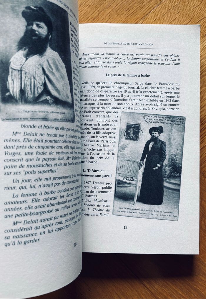 De La Femme À Barbe À L'Homme-Canon - Phénomènes de cirque et de baraque foraine - photo numéro 7