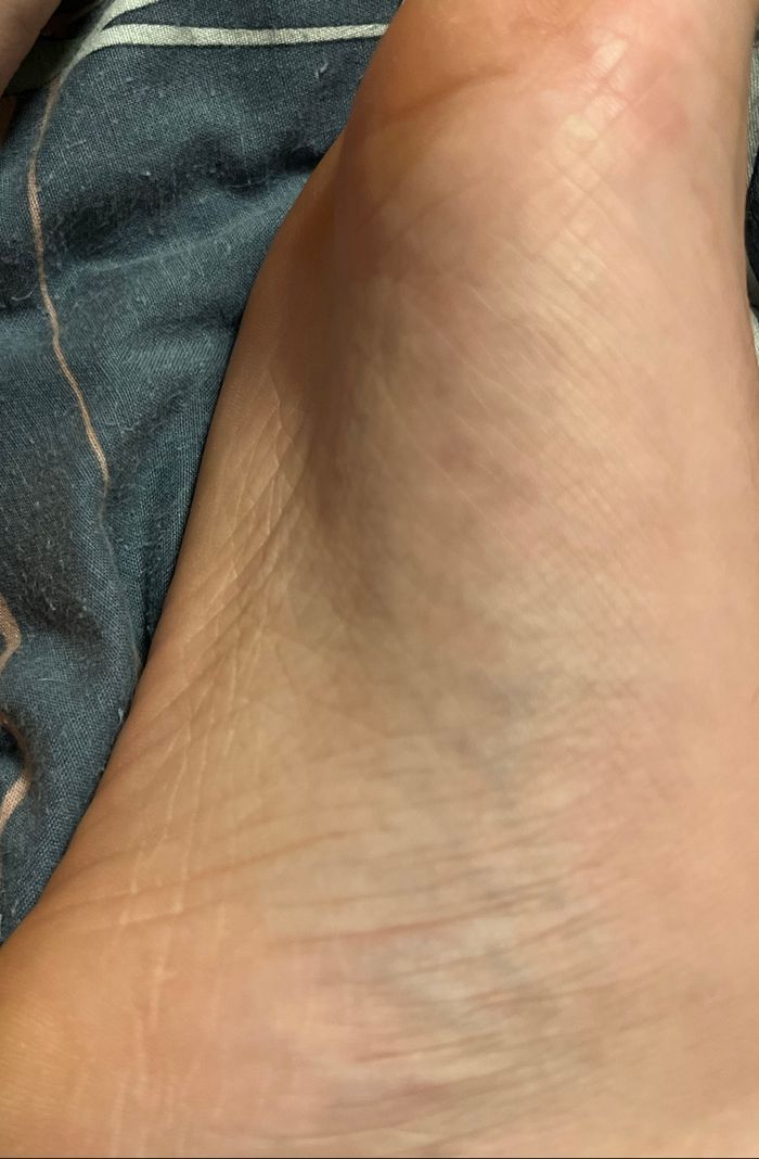 Pieds