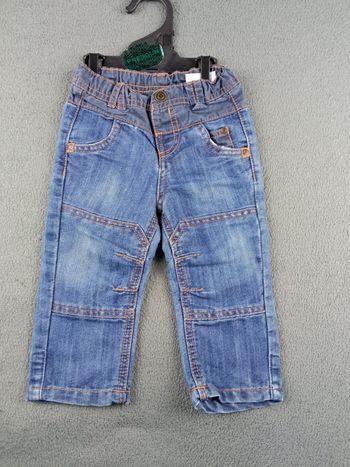 Jean 9 mois TAP à l'œil