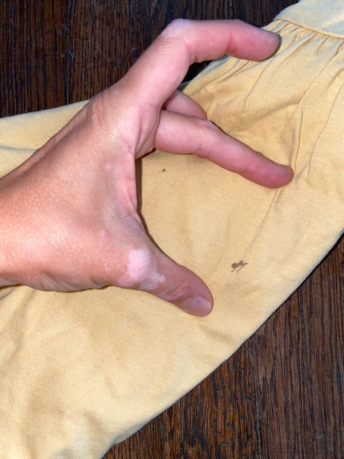 Robe H&M 6 ans - photo numéro 3