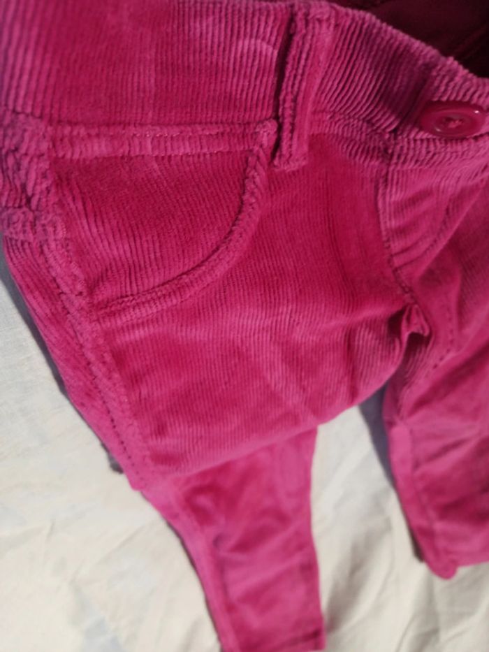 Skinny Benetton - photo numéro 3