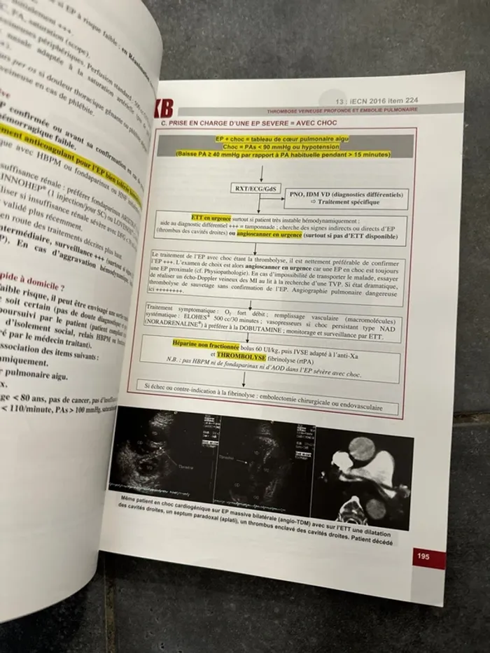 Livres. Cardiologie vasculaire. - photo numéro 4