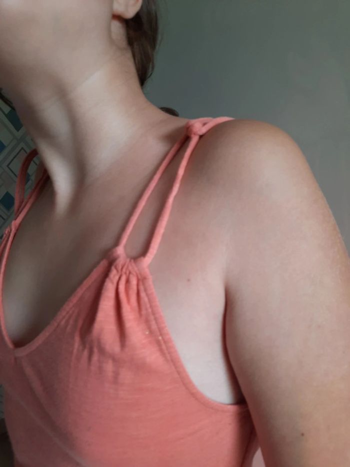 Robe été - photo numéro 3