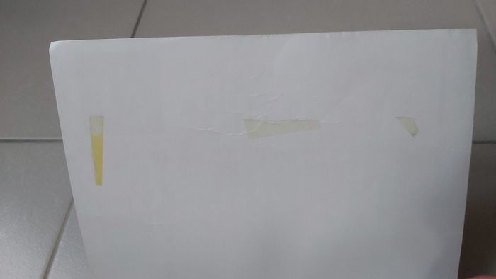 Cahiers de l'infirmière Soins infirmiers aux personnes atteintes d'hemopathies et de cancers - photo numéro 5