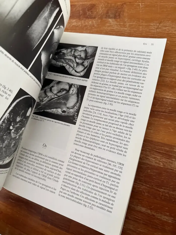 Livre I.R.M. ostéoarticulaire et musculaire - photo numéro 5
