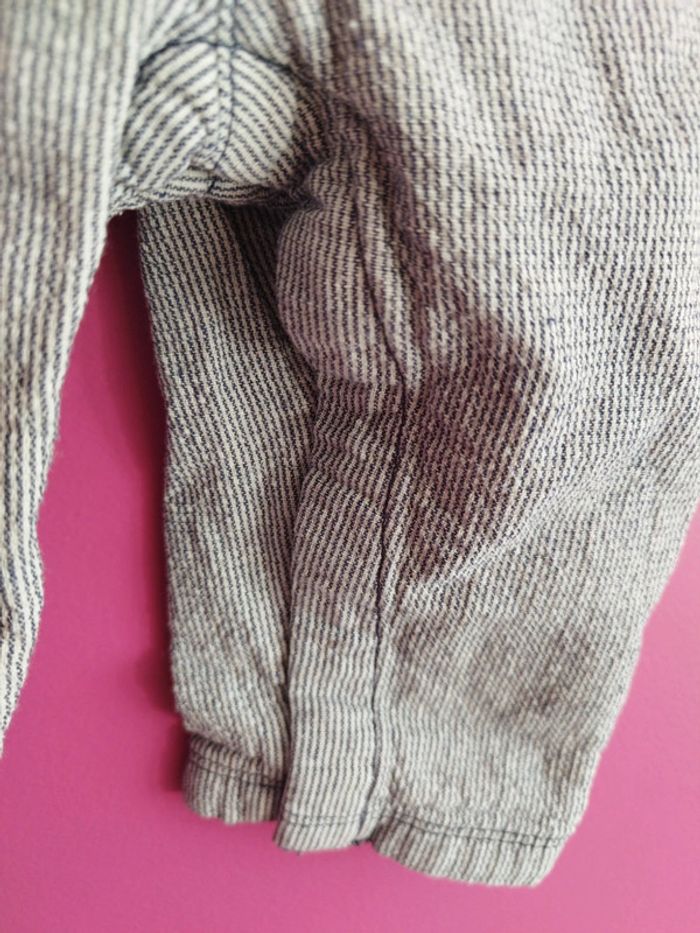 Salopette b4 - photo numéro 4