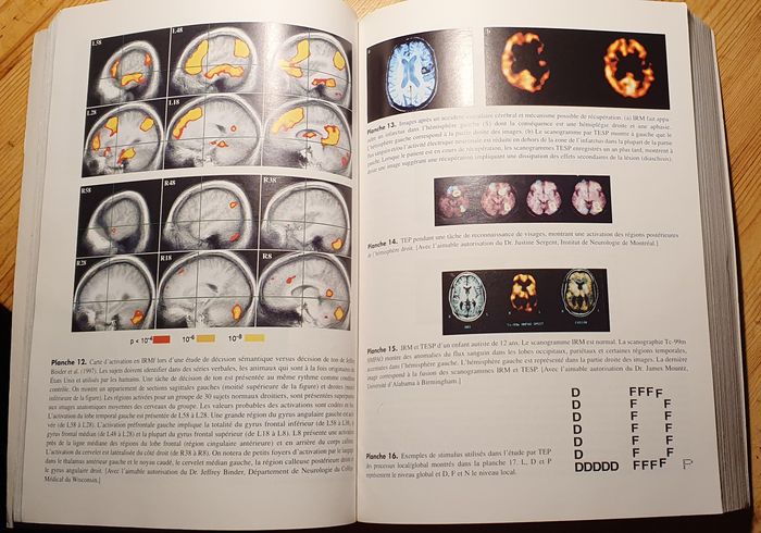 Cerveau gauche cerveau droit à la lumière des neurosciences de Sally P. Springer - photo numéro 4