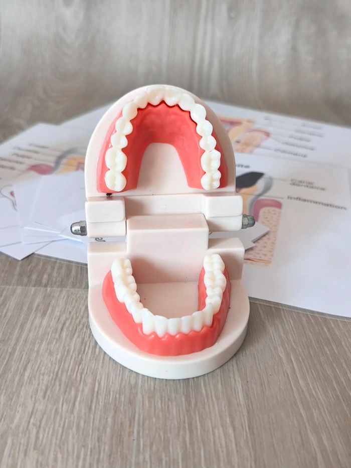 Kit anatomie de la dent saine et la dent cariée - photo numéro 6