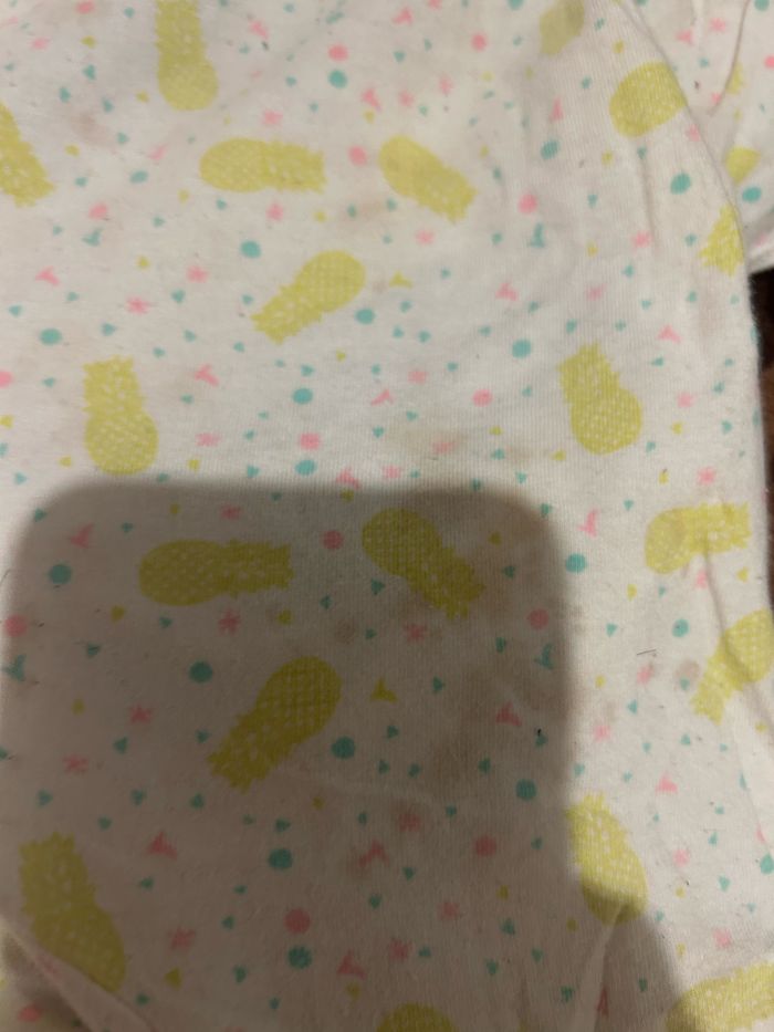 Grenouillère - photo numéro 4