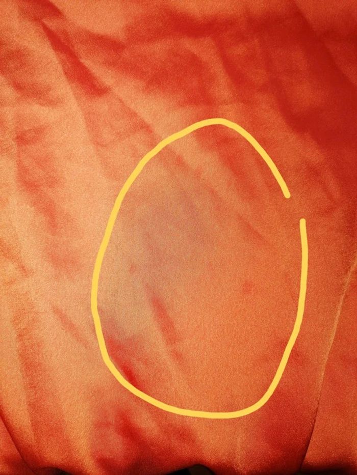 Bouse bodies Les sœurs K. Petite imperfection - photo numéro 15