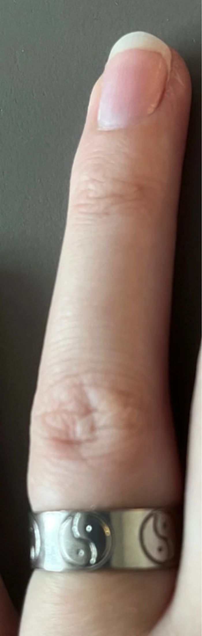 Bague