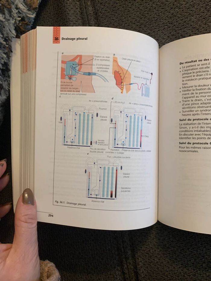 Livre fiches de soins infirmiers avec dvd - photo numéro 18