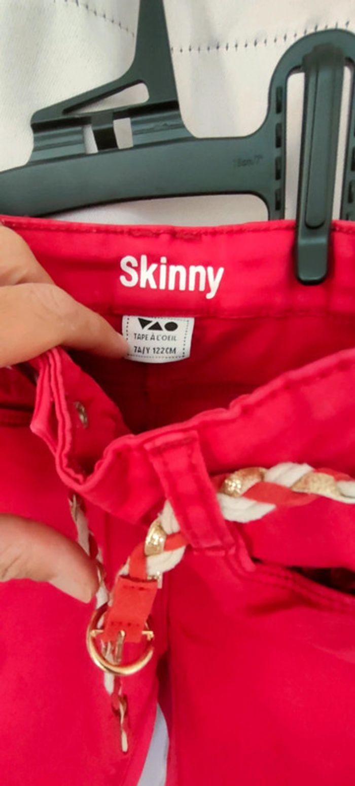 Skinny 7 ans - photo numéro 2