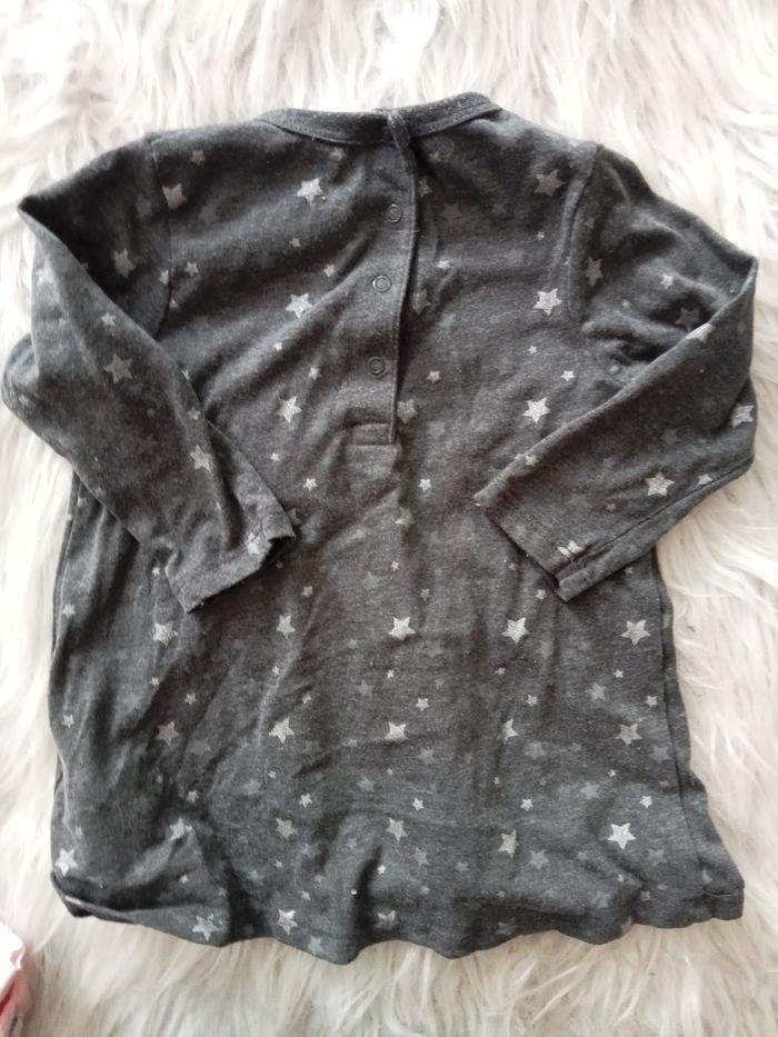 Robe bébé